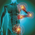 Understanding Chronic Inflammation: Causes, Treatments, and Management