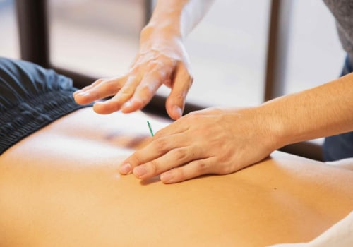 Understanding Acupuncture for Chronic Pain Relief